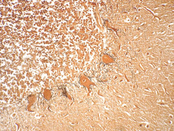 Argentaffin cells